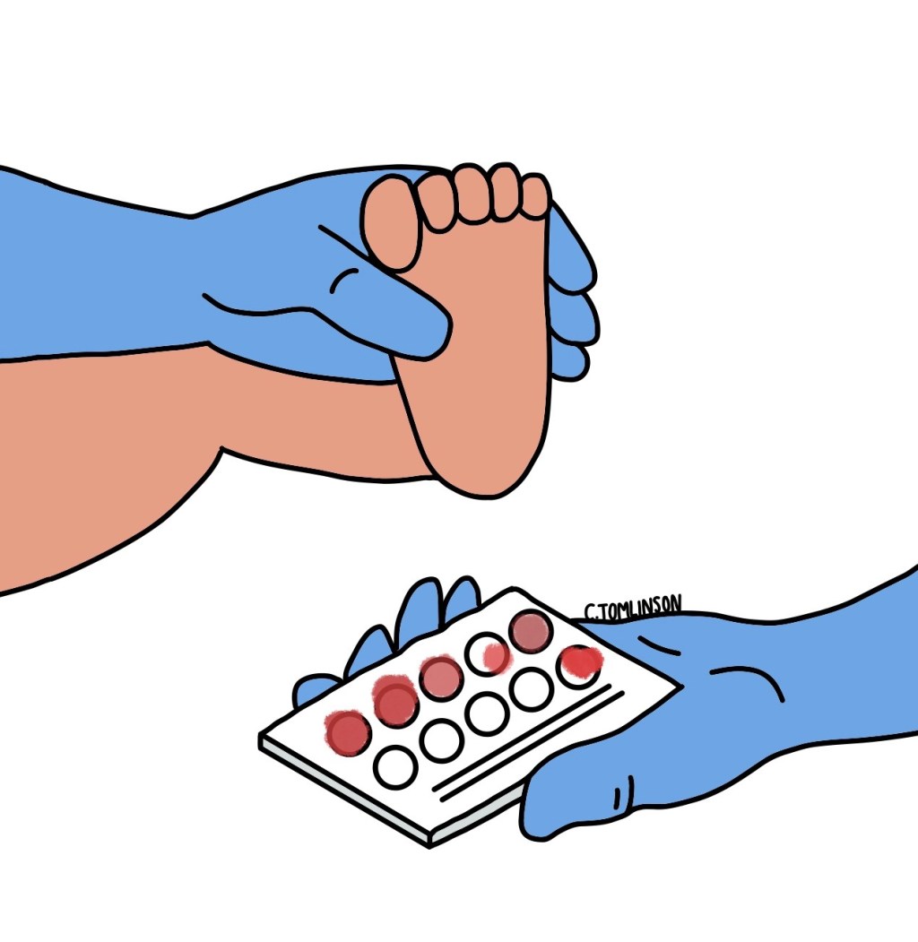 Medical Marvel Monday: A Huge Step Forward for the Tiniest Patients – Newborn Screening for SMA